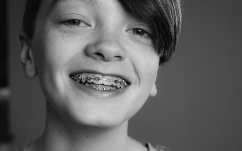 Your Ultimate Guide to Braces for Kids