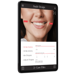 Digital Smile Design