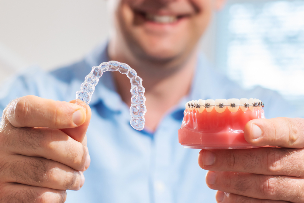 Invisalign; traditional braces