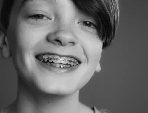 Your Ultimate Guide to Braces for Kids