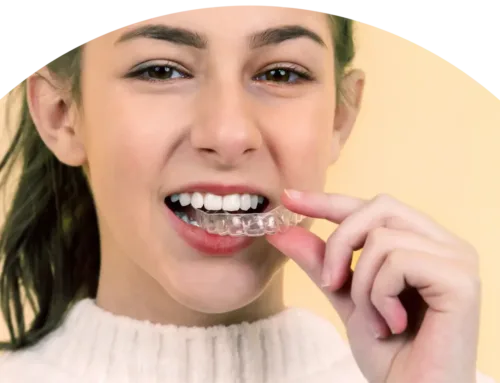 The Benefits of Invisalign for Teens & Adults